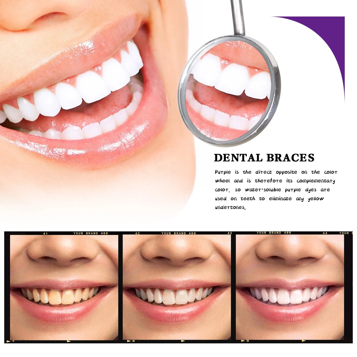 Mousse limpiador dental V34