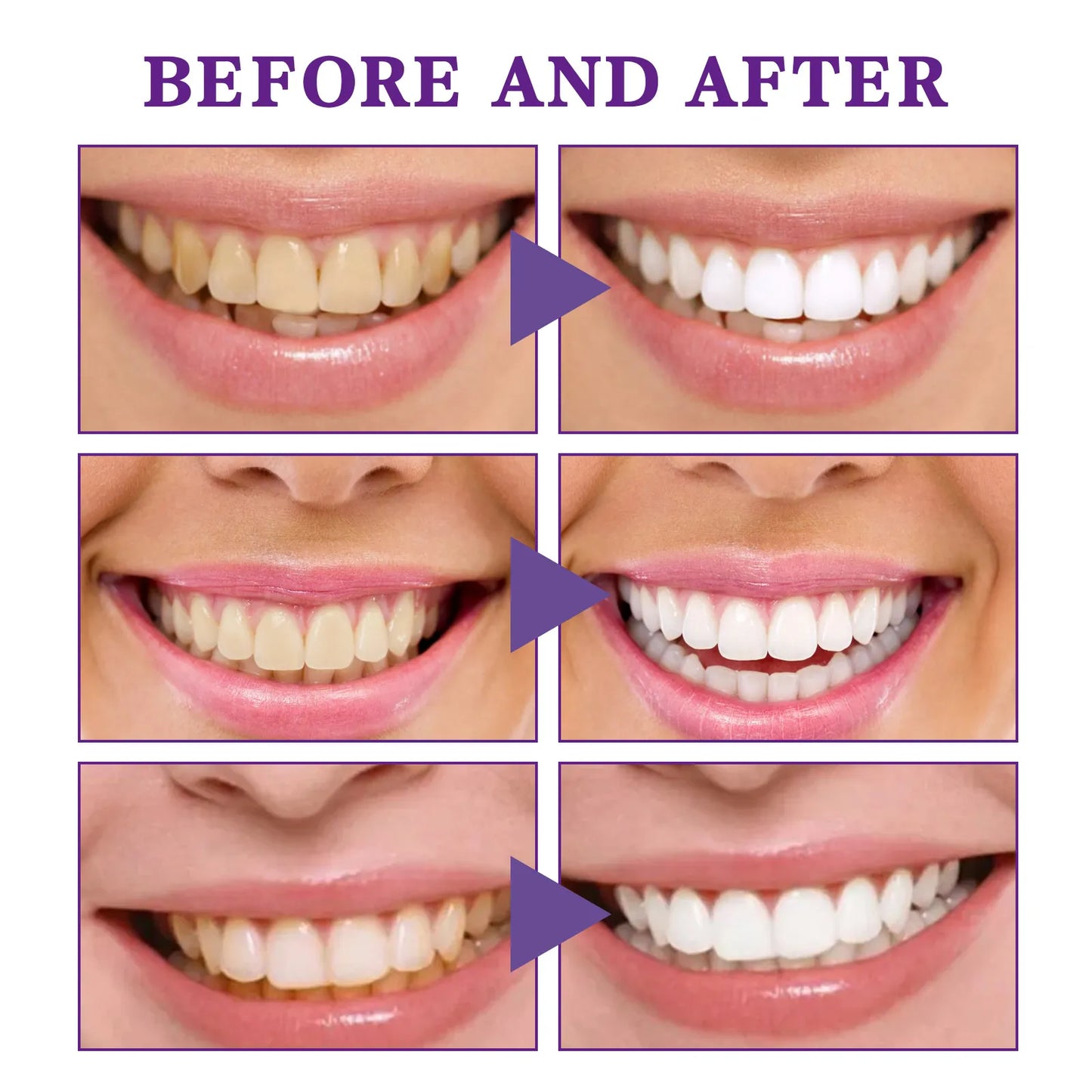 Mousse limpiador dental V34